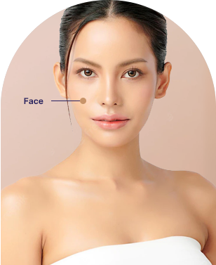 Microneedling Treatment in Ahmedabad