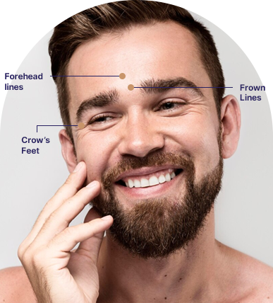 Anti Wrinkle Injections for Men, Ahmedabad
