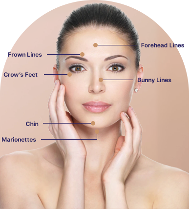 Anti Wrinkle Injections For Women