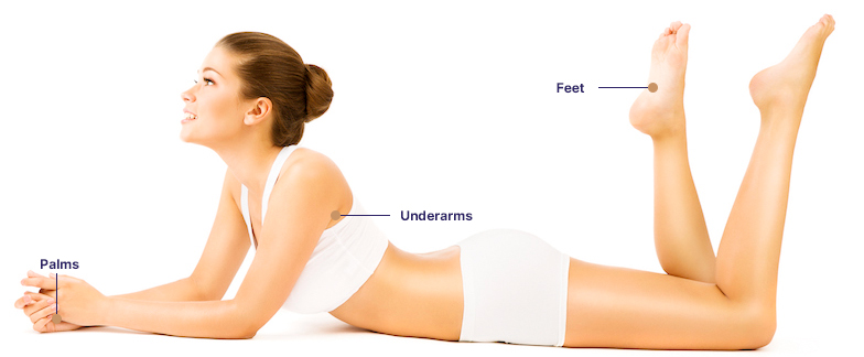 Hyperhidrosis Treatment