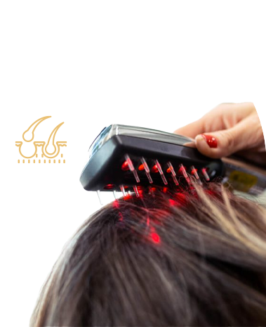 Laser Hair Growth Treatment in Ahmedabad