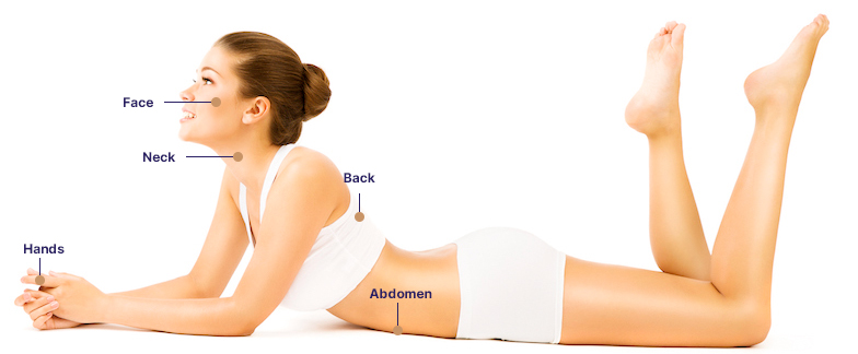 Microdermabrasion Treatment in Ahmedabad