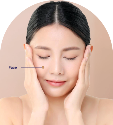 Best Rosacea Treatment in Ahmedabad